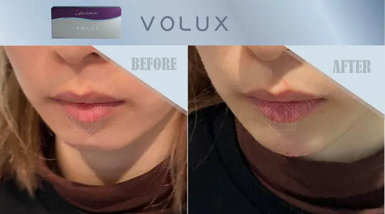 Voluma 05 2500x1391