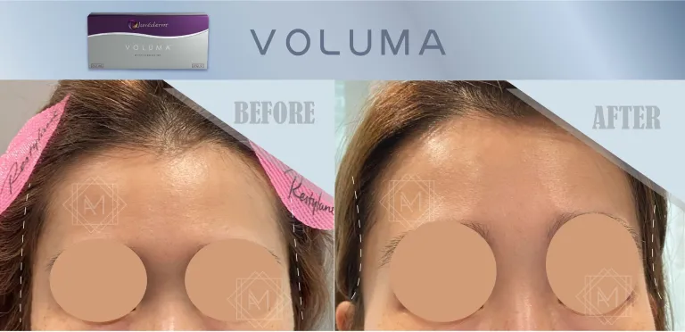 Voluma 06 2500x1211